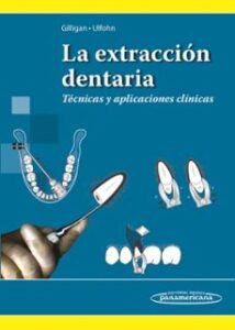 La Extracción Dentaria. Técnicas Y Aplicaciones Clínicas