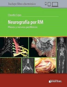 Libro, Audiolibro Neurografia Por Rm. Plexos Y Nervios Perifericos (libro + E-book) Neurografia Por Rm. Plexos Y Nervios Perifericos (libro + E-book)